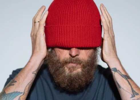 Jovanotti, l’operazione dopo l’incidente non è andata benissimo